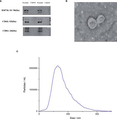 Urinary exosomal long non-coding RNAs as noninvasive biomarkers for diagnosis of bladder cancer by RNA sequencing